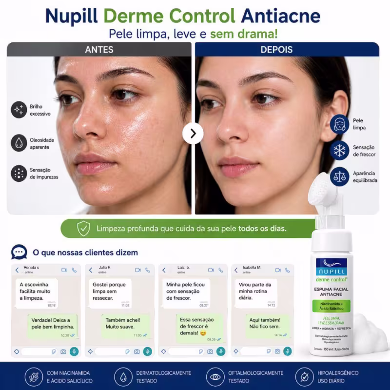 Espuma Facial Antiacne Nupill Derme Control Niacinamida e Ácido Salicílico 150ml