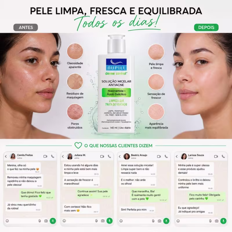 Solução Micelar Antiacne Nupill Derme Control Niacinamida e Ácido Salicílico 140ml