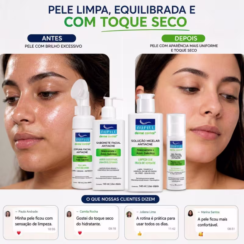 Kit Completo Nupill Derme Control Antiacne