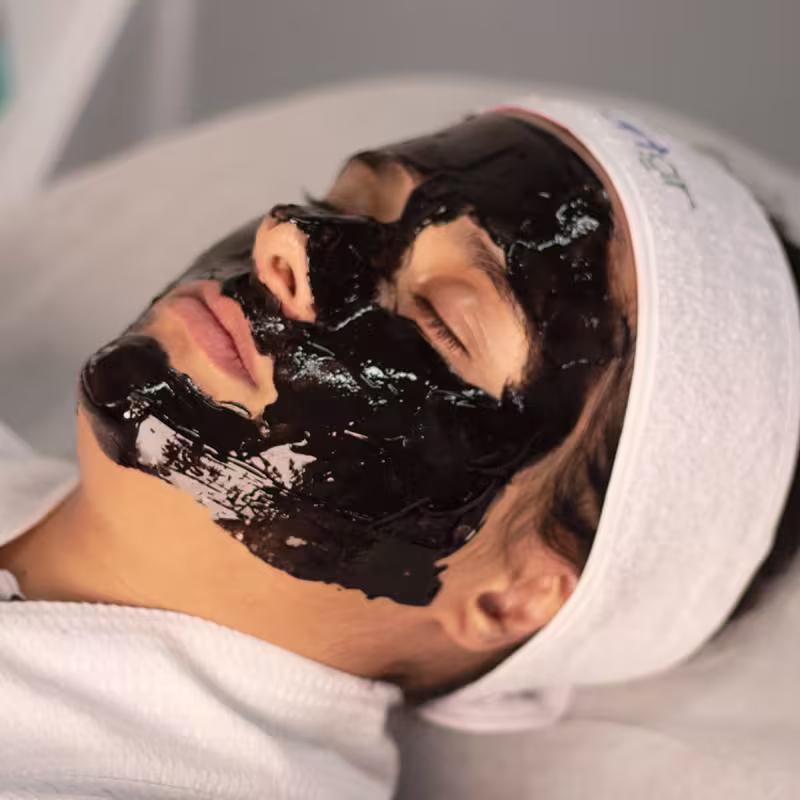 Smart Exo - Exossomos – Máscara Facial – 120 g | Smart GR