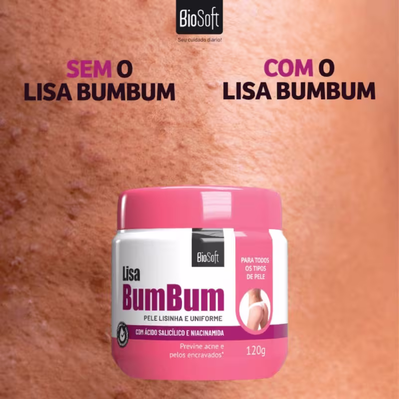 Tratamento Para Espinhas No Bumbum Foliculite Pelo Encravado
