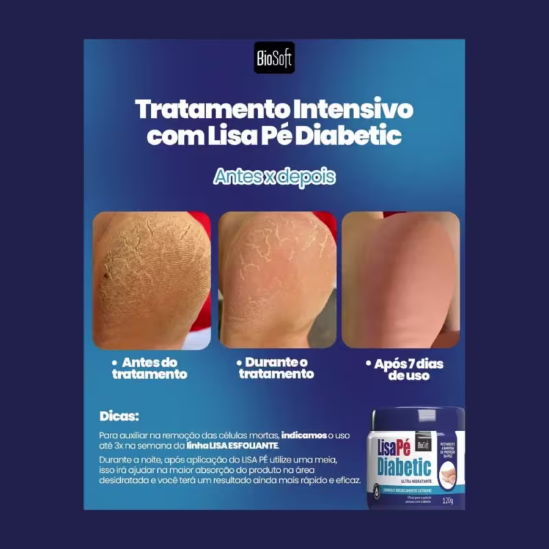 3 Hidratação Profunda Para Pés Diabéticos Ressecado Rachados