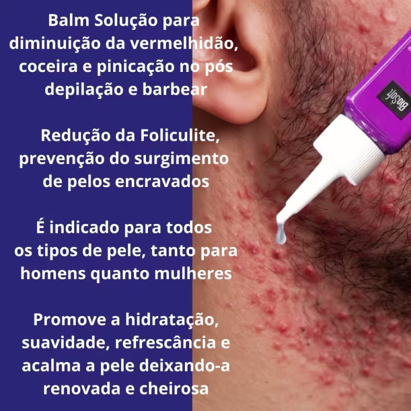 2 Locao Pos Barba Calmante Foliculite Coceira Pelo Encravado