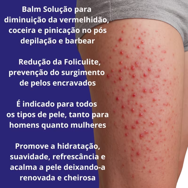 Foliculite E Pelo Encravado + Clareador Gluteo Virilha Coxa