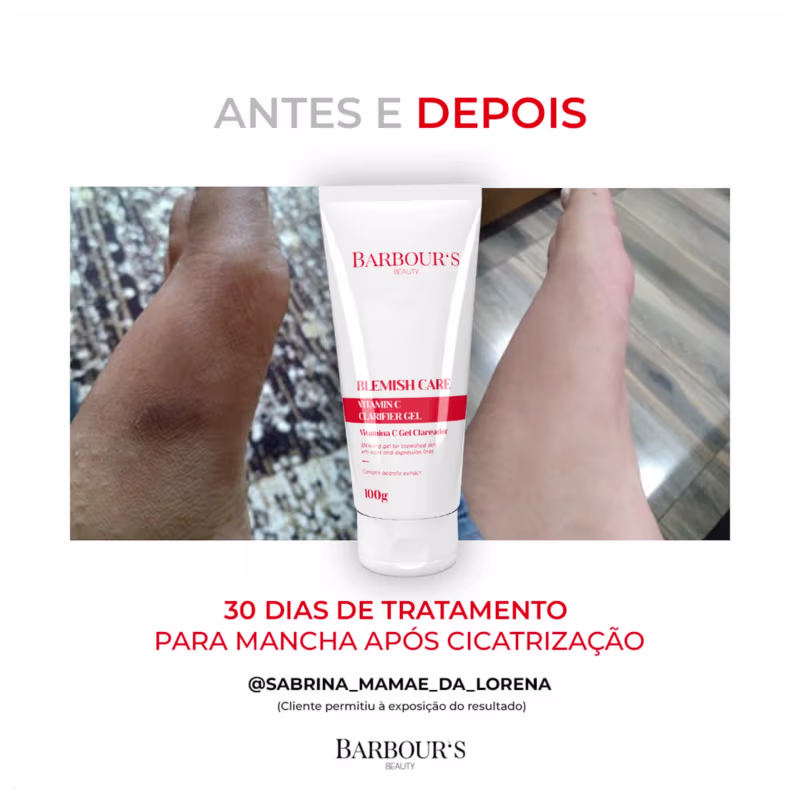 Barbour's Beauty Blemish Care Vitamin C - Sérum Facial 30ml