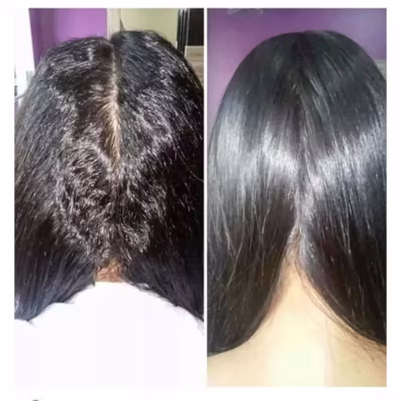 Estas imagens mostram os resultados do realinhamento capilar da marca Naelly St Professional. No antes, cabelos com um aspecto opaco e danificado. No depois, após o tratamento, os mesmos cabelos apresentam efeito liso e brilho.