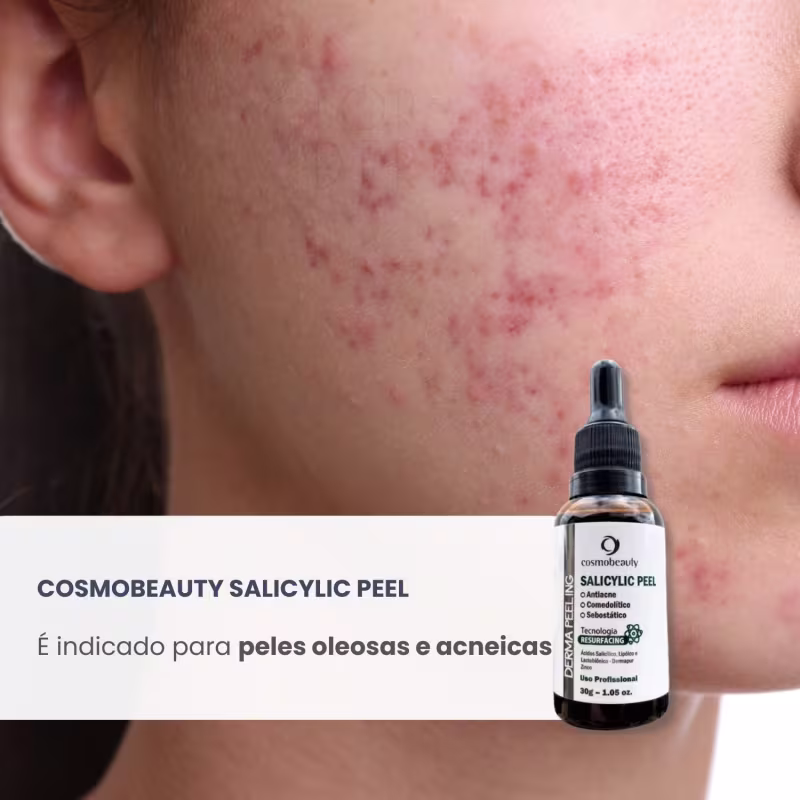 Cosmobeauty Peeling Anti Acne Salicylic Peel Derma Peeling 30g
