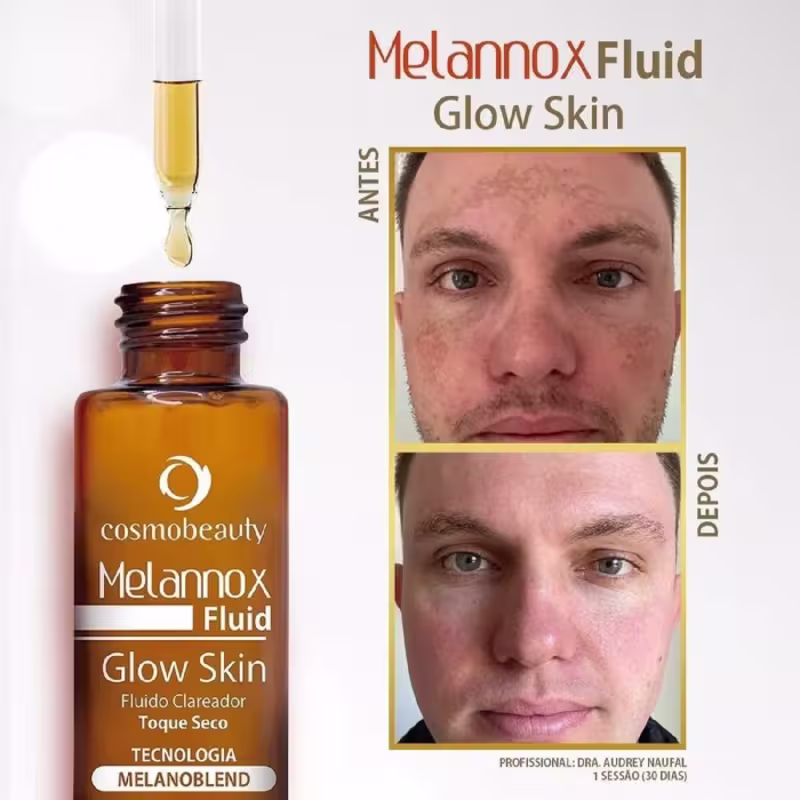 Melannox Fluid Glow Skin, Cosmobeauty, Sérum Clareador De Melasma Ultraconcentrado 30ML