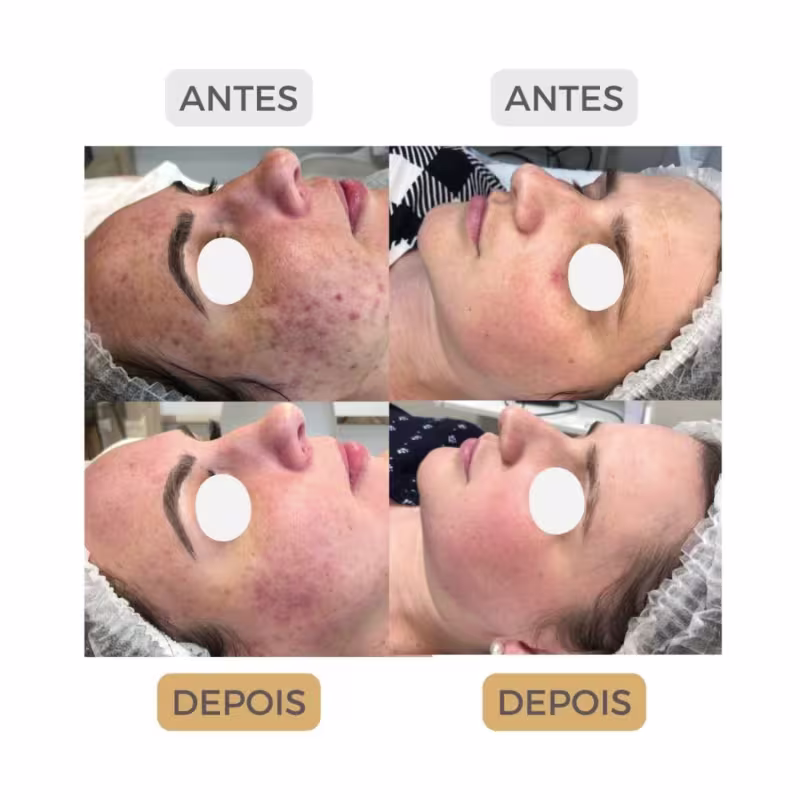 Peeling Rose de Mer Mar Morto Sache 1 Aplicacao Frete Gratis