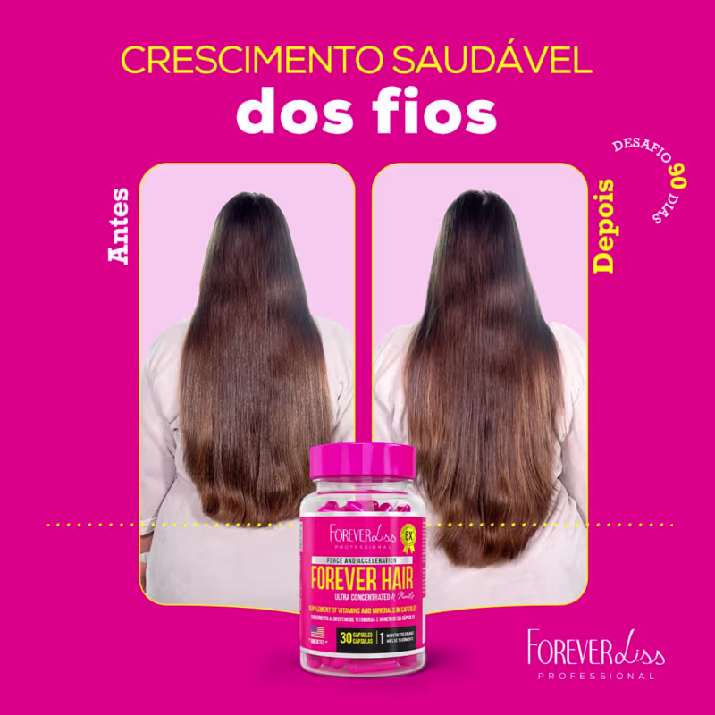 Kit 2 Suplementos Vitaminas Crescimento Capilar Forever Liss