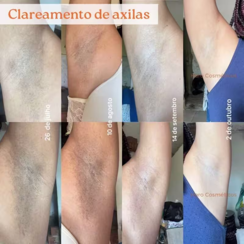 Trio Clareador de Manchas - 3 sabonetes