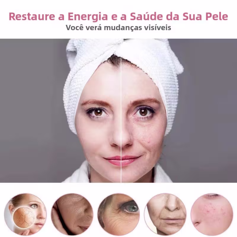 Massageador Radiofrequência Contorno Facial  Ems Flacidez