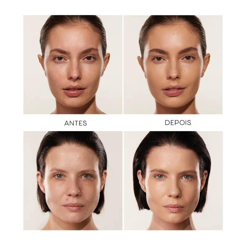 As imagens mostram antes e depois de duas mulheres, com os cabelos para trás e foco no rosto. Nas fotos "depois", as peles aparecem mais uniformes, com menos manchas e imperfeições visíveis.