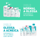 CeraVe - Gel de Limpeza Facial 340g (4)