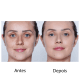 Clinique Beyond Perfecting Foundation + Concealer 6.5 Buttermilk - Base 2 em 1 30ml (3)