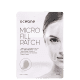 Océane Micro Fill Patch - Adesivo com Ácido Hialurônico (2 Unidades) (1)