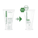 NeoStrata Oil Control Oily Gel Plus para Pele Oleosa - Gel Antissinais Facial 125g (6)