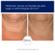 NeoStrata Triple Firming Neck - Creme Redutor de Linhas para Pescoço e Colo 80g (8)