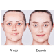 Pink Cheeks Pink Stick 60KM FPS 90 – Protetor Solar Facial 14g (5)