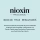 Nioxin Scalp Recovery - Shampoo 200ml (9)