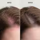 Keune Scalp Sensitive - Condicionador 1L (5)
