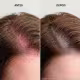 Kit Keune Scalp Sensitive - Tratamento Calmante Completo (3 Produtos) (5)