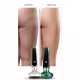 Massageador Ventosa p/ celulite Elétrico Infravermelho Corpo (5)