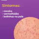 Foliculite E Pelo Encravado + Clareador Gluteo Virilha Coxa (6)