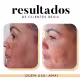 Ritual Essencial + Prebiótica | Rituária | Clareador Manchas e Melasma (10)