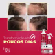 Kit Lizz ante Professional S.O.S Crescimento (6 Produtos) (9)