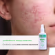 Cosmobeauty Acne Spec - Tônico Facial 140ml (5)