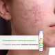Cosmobeauty Cosmoblock Blur Anti Acne A FPS 80 Bege - Protetor Solar 50g (5)