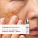 Cosmobeauty Mellanocorretor Sérum Clareador Melasma e Manchas Pós Inflamatórias 30g (5)