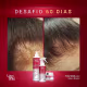 Kit SOS Crescimento Acelerado Antiqueda Fortalecimento Capilar Combate Calvície Anticaspa Trata Alopecia (9)