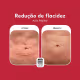 Kit Cicatribem LipoPele - Gel Redutor de Medidas (4 Unidades) (5)