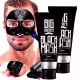 Kit 3x Removedor De Cravos Limpa Poros Black Mask Big Barber (2)