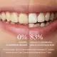 Alpine White Fitas Clareadoras Dentes Sensíveis (4)