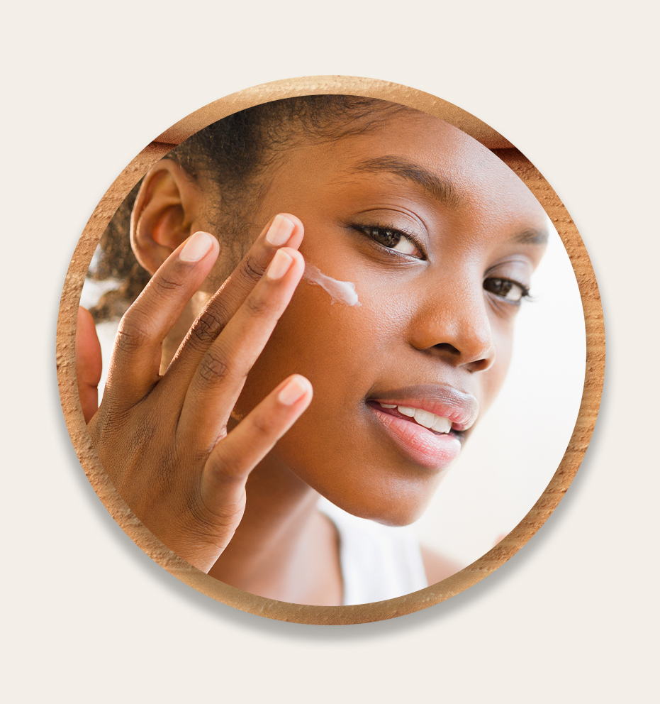 Saiba qual é o melhor tipo de protetor solar para melasma