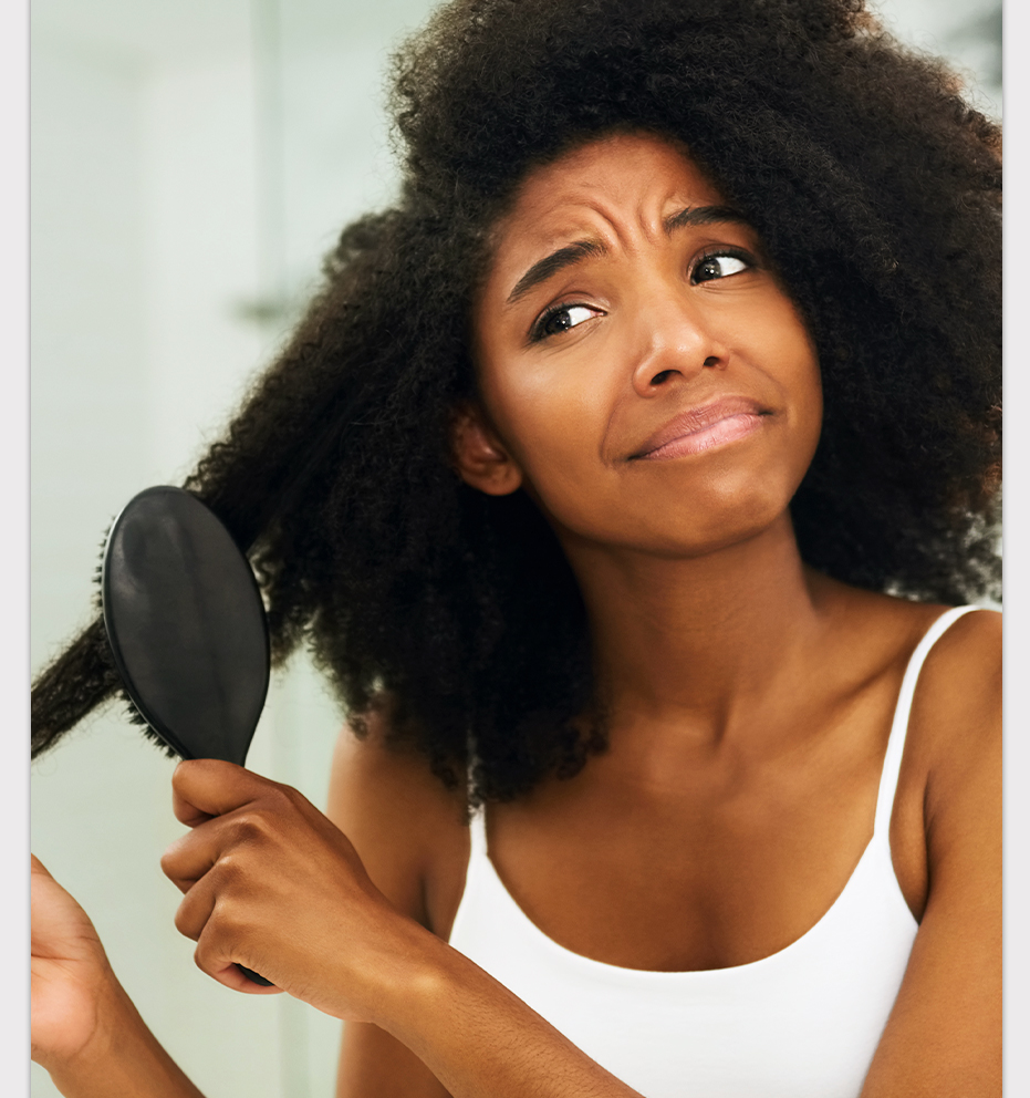 síndrome do cabelo impenteável