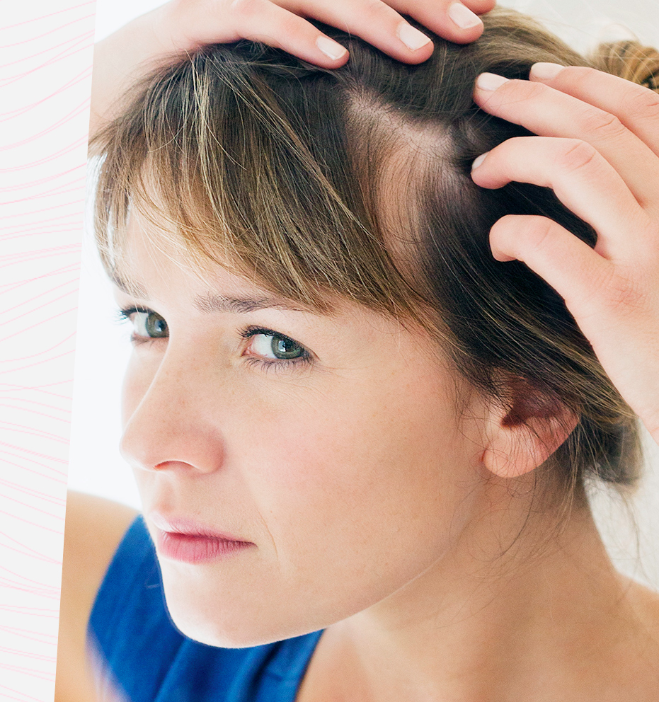 Saiba tudo sobre alopecia: tipos, causas e tratamento
