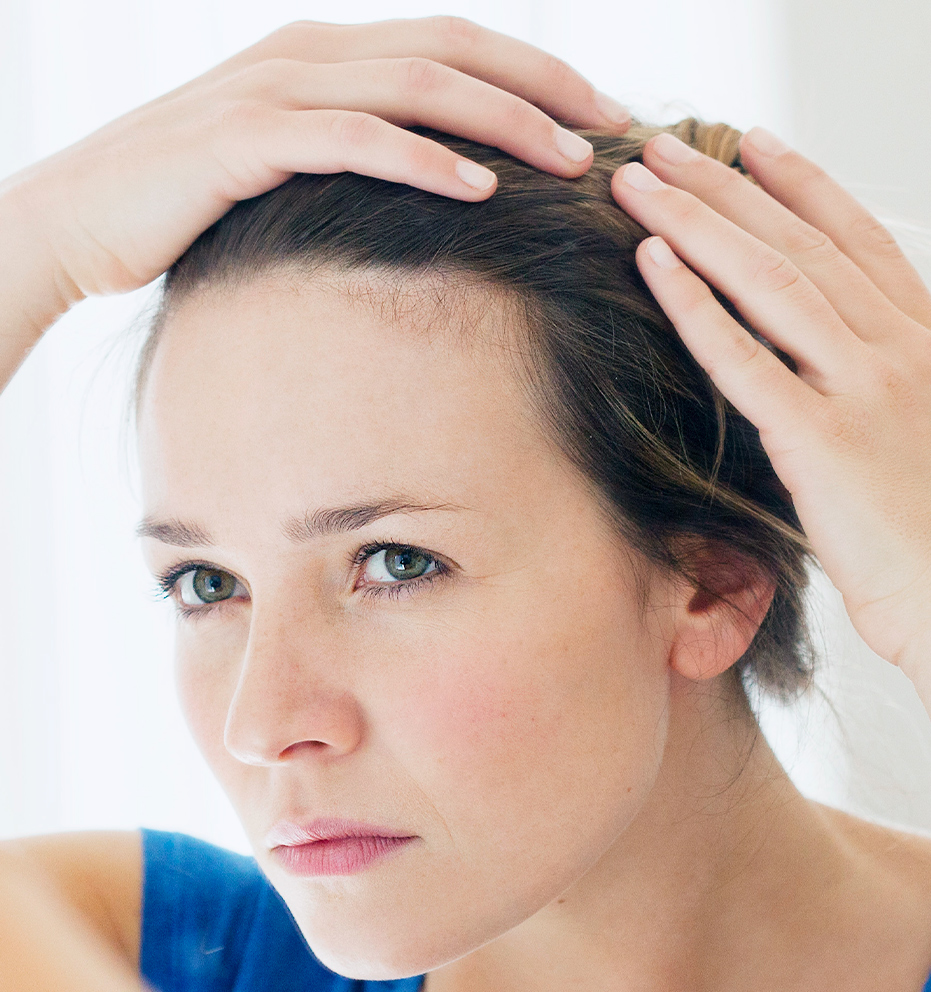 Queda de cabelo pós-parto: causas, sintomas e tratamento