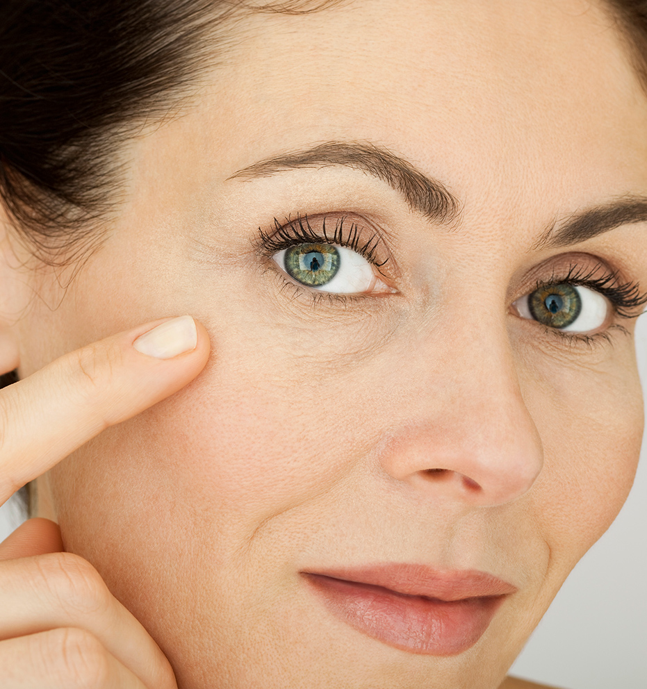 Botox preventivo: saiba quando fazer