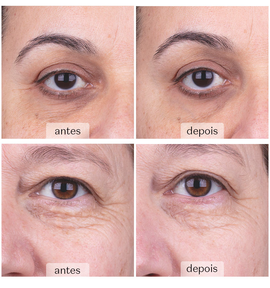 Resultados após 7 dias de uso contínuo da da Base Make B. Hyaluronic.