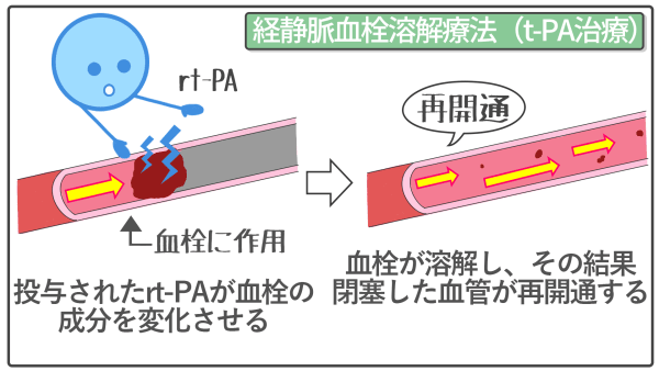 治療法