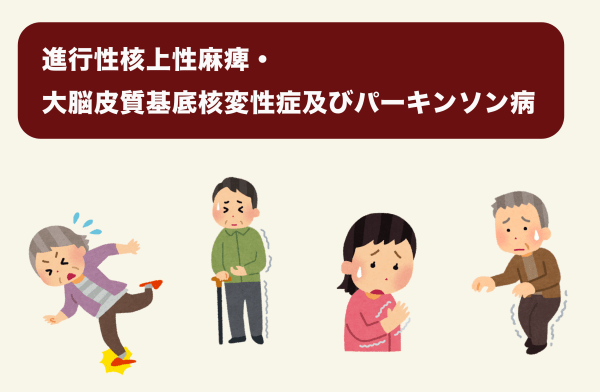 パーキンソン病のイメージ