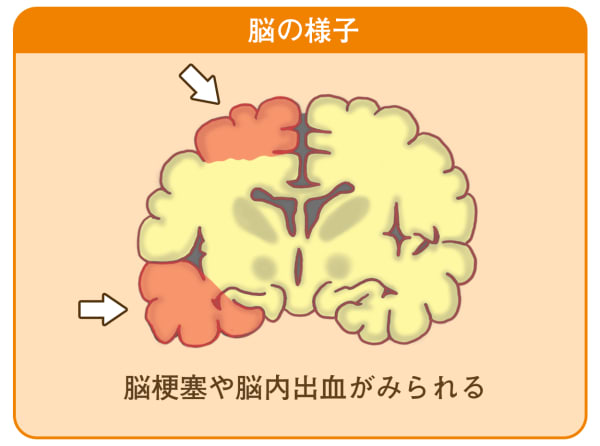 損傷部位