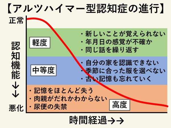 アルツハイマーの進行段階