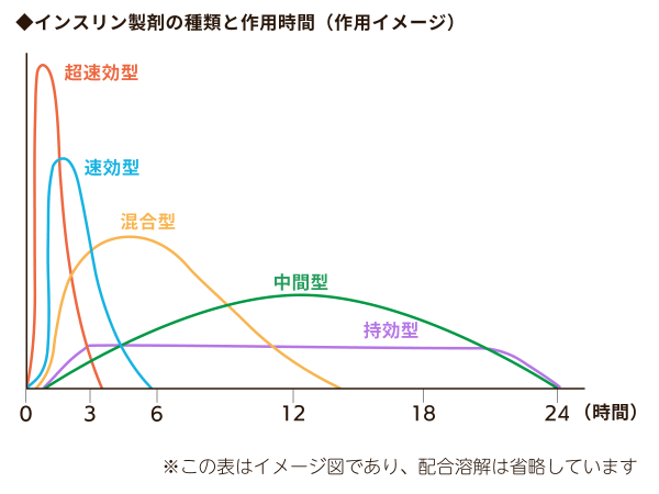 インスリン製剤の種類と作用時間