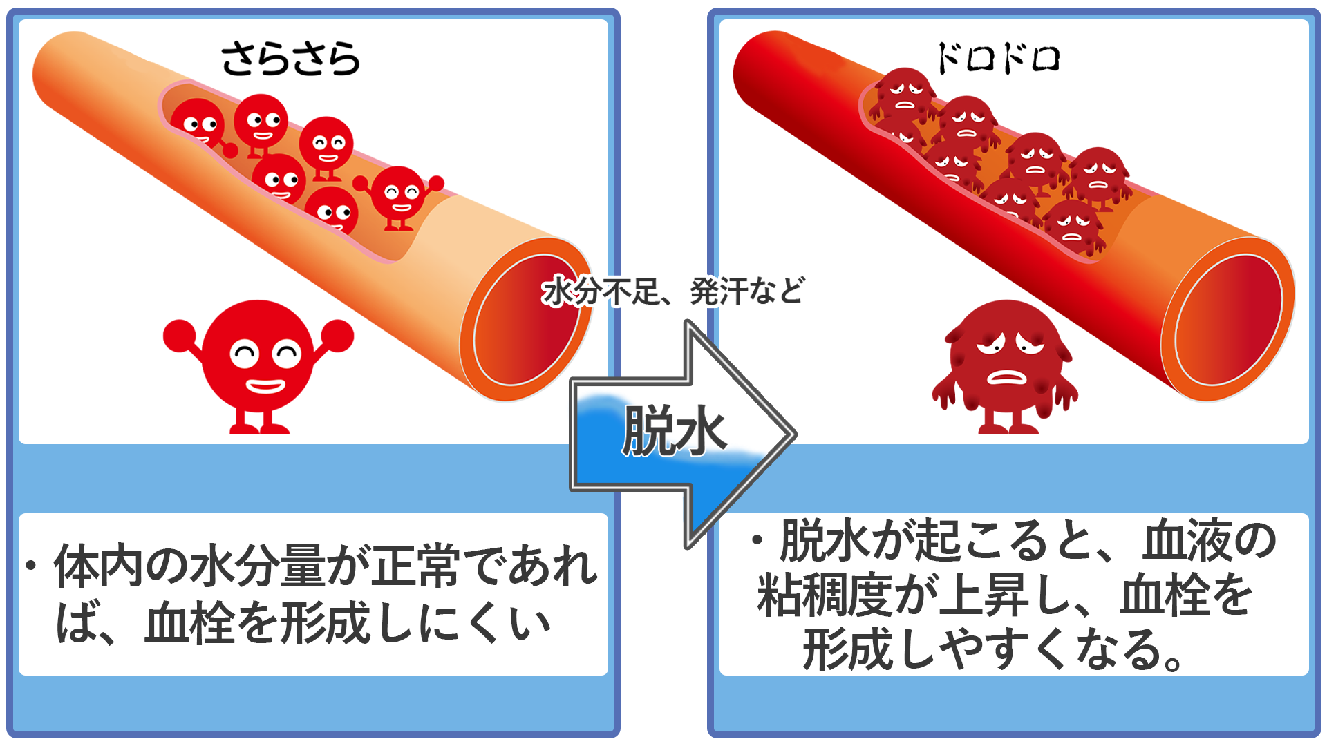 脳梗塞の原因とは 症状や前兆 予防方法から治療の流れまで全て紹介 サービス付き高齢者向け住宅の学研ココファン