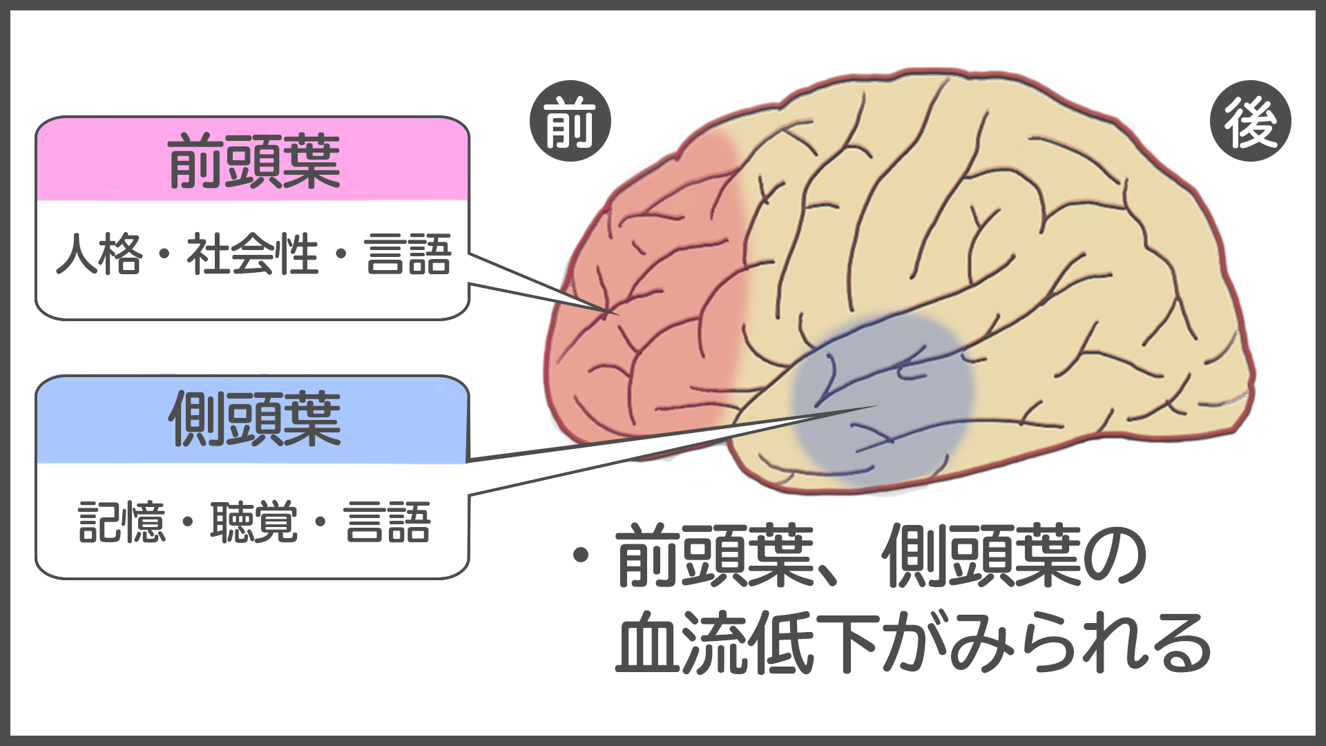 医師監修 前頭側頭型認知症 ピック病 とは 症状や原因 治療法まで全て紹介 サービス付き高齢者向け住宅の学研ココファン